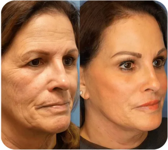 š„ćOfficial Brand StorećInstant face Tightener No-Filter Primer(Limited Time Discount)